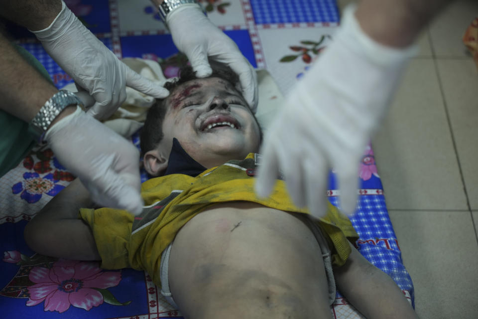 Un niño palestino herido tras un bombardeo israelí es atendido en el hospital en Deir al-Balah, al sur de la Franja de Gaza, el 17 de octubre de 2023. (AP Foto/Hatem Moussa)