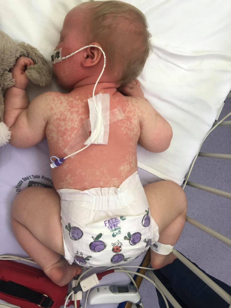 A mum is urging other parents to vaccinate their children after her newborn daughter contracted measles [Photo: Facebook]