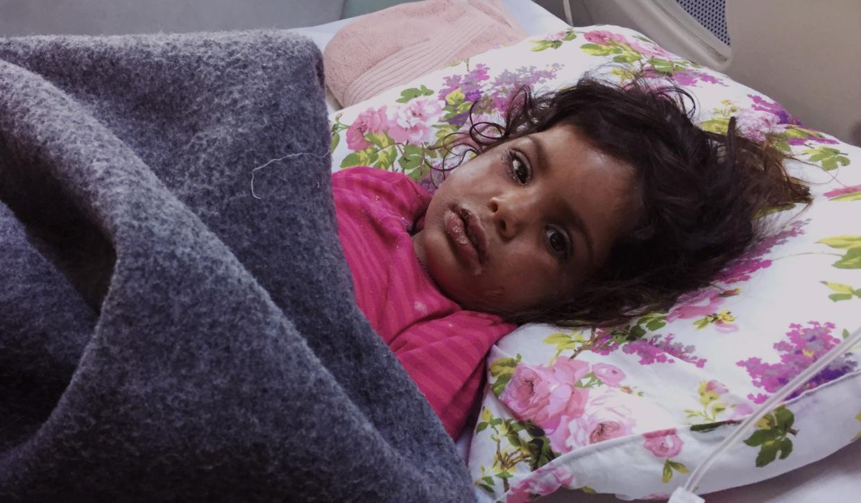 Toddler age girl lies helplessly with blisters after her face was hit with chemicals in a mortar attack. (Photo: Ash Gallagher for Yahoo News)