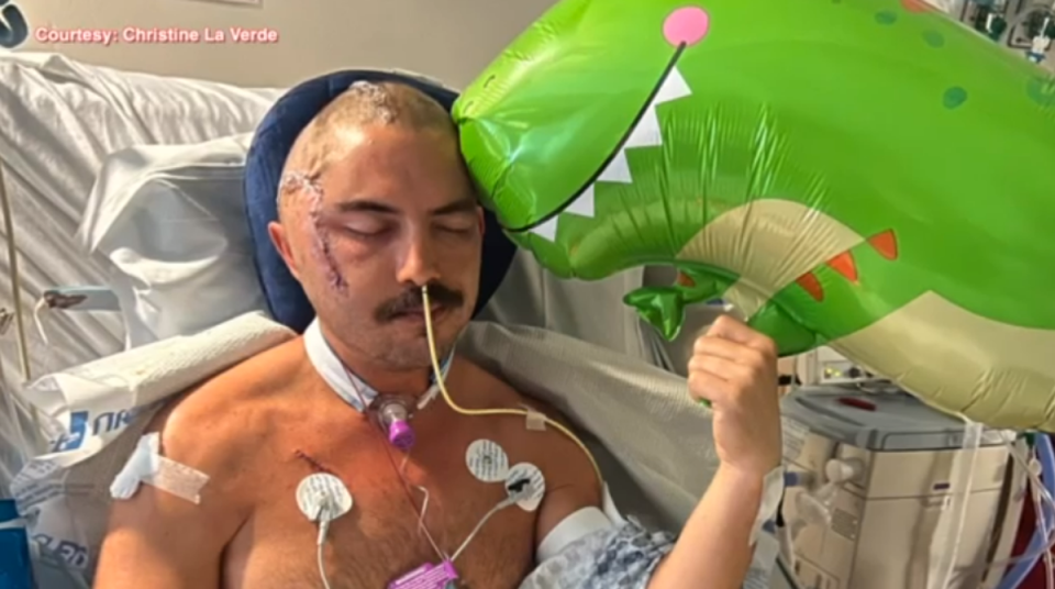 Juan Carlos La Verde, 34, recovering in hospital after a six-hour surgery to treat wounds from an alligator attack where he sustained injuries to both his head and jaw (ABC Action News/video screengrab)