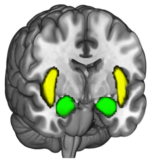 This view of the brain from the front shows the location of the brain activity in the amygdalae (the two orange/gold nodes in the illustration) and the insula cortex. (Photo: the Brain and Creativity Institute at USC)