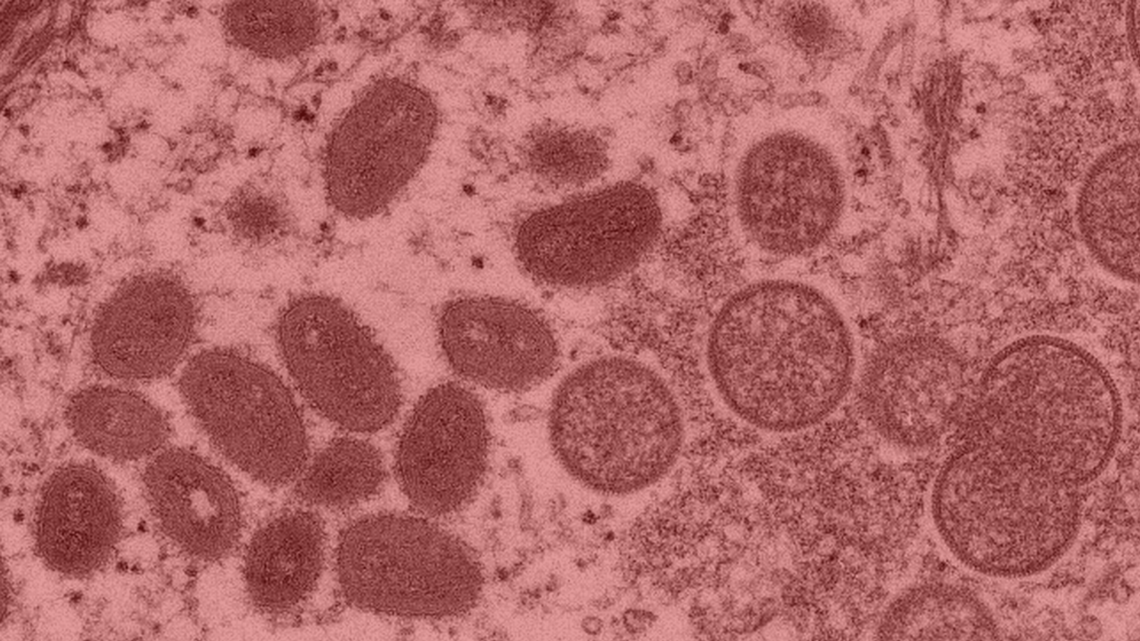 Southwest District Health announced Friday in a news release that an Idaho resident in Canyon County tested positive for monkeypox.