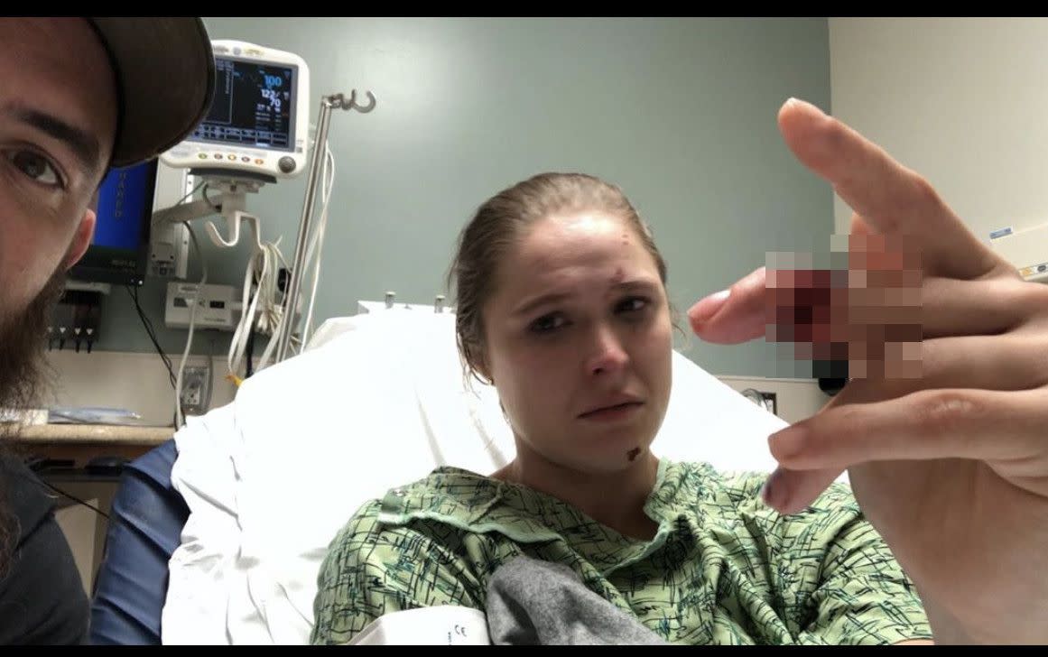 Wrestler Ronda Rousey suffers an injury while filming a scene for "9-1-1" that left her with a nearly severed middle finger. "Freak accident, first take of the day a boat door fell on my hand, I thought I just jammed my fingers so I finished the take before looking," Rousey explained in a caption alongside the gruesome injury.