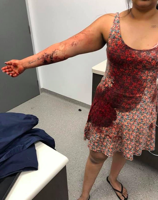 Coco's owner posted photos of her clothes and body covered in blood on Facebook (Facebook)