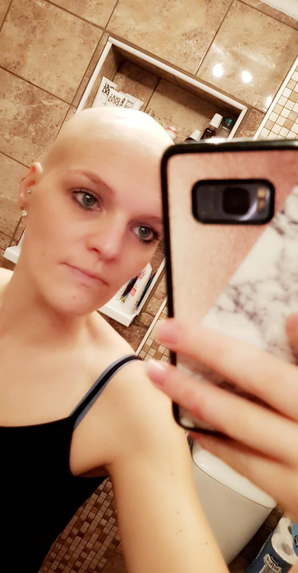 ***EMBARGOED 2PM BST / 10AM EST OCTOBER 29 2019***    Claire Curtis after losing her hair. Claire Curtis, 30, who believed her headaches and general lethargy were down to baby brain was shocked to discover she actually had an incurable brain tumour. See SWNS story SWOCbabybrain. A new mum who put her headaches and tiredness down to 'baby brain' was devastated to discover she actually had an incurable brain tumour. Claire Curtis, 30, had been experiencing headaches and feeling tired for a months before her diagnosis but just put it down to the stress of being a new mum. Doctors prescribed her medication for migraines, but when Claire started vomiting in the early hours of the morning, she knew it was something more sinister. An MRI scan revealed that Claire had an incurable brain tumour the size of an orange, and she is now battling the cancer to get more time with her family.