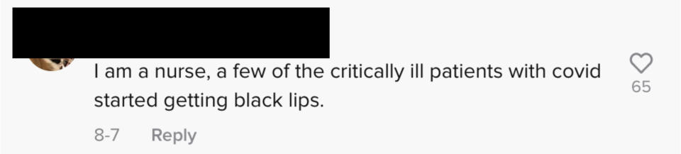 Another said, "I am a nurse, a few of the critically ill patients with COVID started getting black lips"