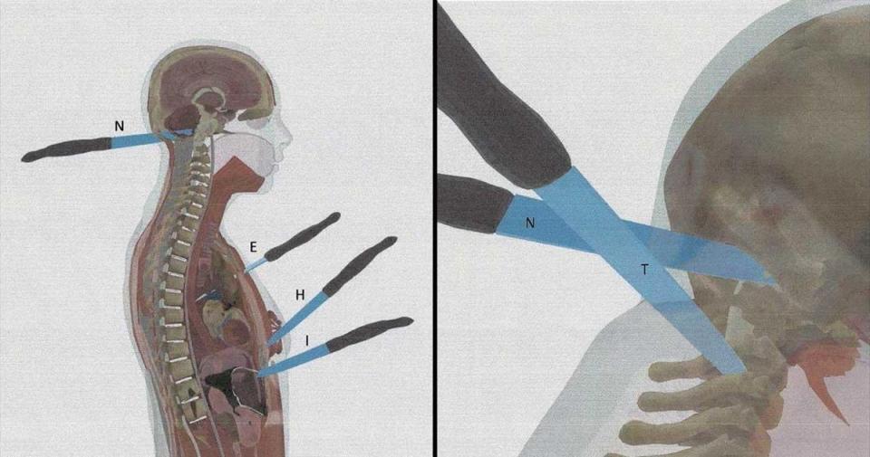A computerized rendering shows several of Ellen Greenberg’s stab wounds (Tom Brennan, Greenberg family)