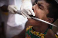 PHUKET, THAILAND - OCTOBER 05: A devotee of the Chinese shrine of Sui Boon Tong Shrine, pierces his cheeks with a sword during a procession at the Vegetarian Festival on October 5, 2011 in Phuket, Thailand. Ritual Vegetarianism in Phuket Island traces it roots back to the early 1800's. The festival begins on the first evening of the ninth lunar month and lasts for nine days. Participants in the festival perform acts of body piercing as a means of shifting evil spirits from individuals onto themselves and bring the community good luck. (Photo by Athit Perawongmetha/Getty Images)