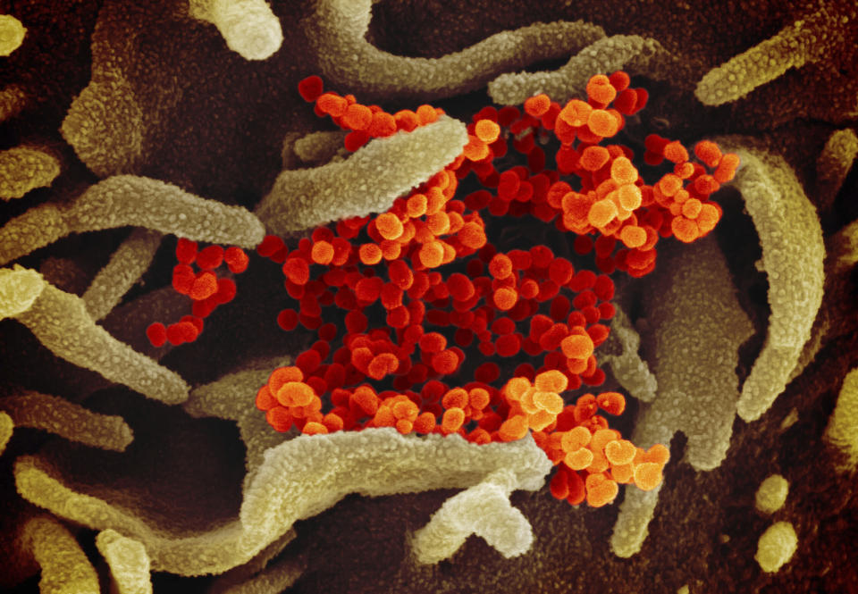 Tests gibt es bisher nur an Zellkulturen: Diese mikroskopische Aufnahme zeigt SARS-CoV-2 (orange) isoliert von einem Patienten in den USA, das aus der Oberfläche von im Labor kultivierten Zellen (grün) austritt (Bild: Uncredited/NIAID-RML/AP/dpa)
