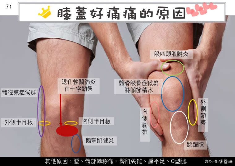  圖片由侯鐘堡醫師提供