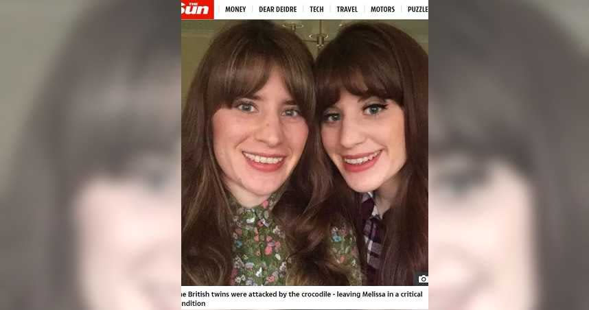 英國一對雙胞胎姊妹遭鱷魚攻擊，妹妹不顧自身安危跳水救姐姐。（圖／翻攝自太陽報）