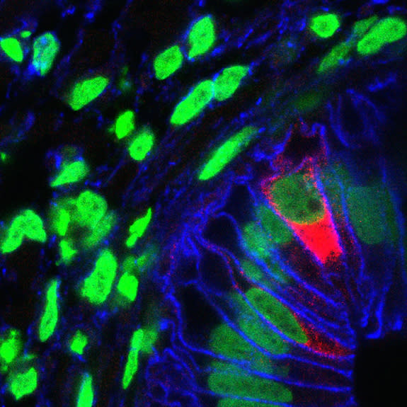 The small stomachs technically aren't organs. Researchers call them organoids, little three-dimensional organlike structures. Other lab-created organoids include the thyroid, brain and intestine.