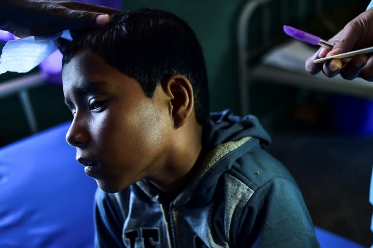 Mohammad Rashed, 11, is one of more than 3,000 Rohingya refugees infected with diphtheria