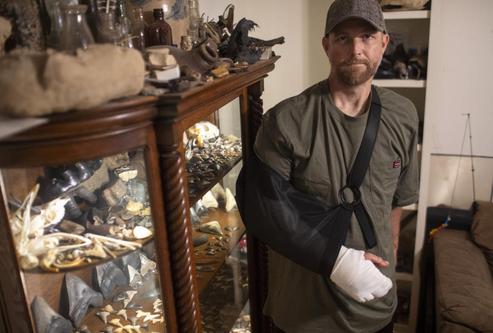 Will Georgitis stands with a collection of fossils he found over the years, was recently attacked by an alligator while out scuba diving in the Cooper River looking for megalodon teeth and other unique items, Friday, April 19, 2024, in West Ashley, S.C. Pinned by an alligator on April 15, to the bottom of the river, Georgitis decided his only chance to survive might be to lose his arm, but he told The Post and Courier he put his feet on the gator and pushed as hard as he could. Somehow he ripped his arm out of the alligator's jaws. (Andrew J. Whitaker/The Post And Courier via AP)