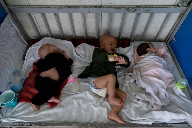 Babies being treated in Kabul for malnutrition. (Photo: Nava Jamshidi via Getty Images)