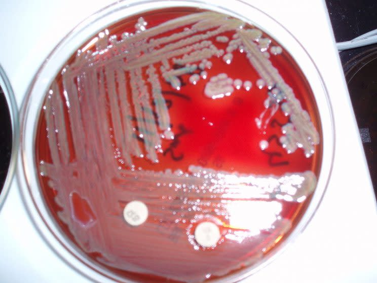 Un cultivo de la bacteria Elizabethkingia, con frecuencia resistente a antibióticos y que ya está presente en un número de casos reducido en EEUU, (Wikimedia)