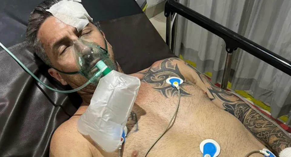 Aussie dad Daniel unconscious in hospital after the Bali accident.