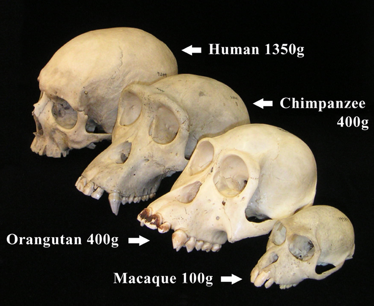 <span class="caption">Primate skulls.</span> <span class="attribution"><span class="source">Christopher Walsh, Harvard Medical School/wikipedia</span>, <a class="link " href="http://creativecommons.org/licenses/by-sa/4.0/" rel="nofollow noopener" target="_blank" data-ylk="slk:CC BY-SA;elm:context_link;itc:0;sec:content-canvas">CC BY-SA</a></span>