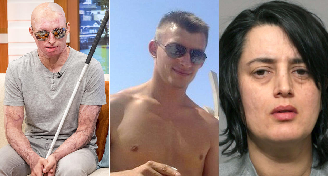 Daniel Rotariu, 33, left, and centre pictured before the attack, was attacked in July 2016 by then partner, Katie Leong, right, who poured sulphuric acid over him as he slept in a bid to kill him.