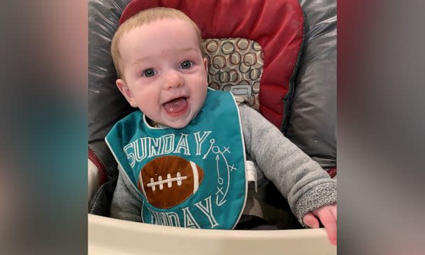 PHOTO: Sara Ward, a mom from St. Louis, Missouri, is sharing her story after her 5-month-old son developed hair tourniquet syndrome in January and had to be rushed to the ER. (Sara Ward )