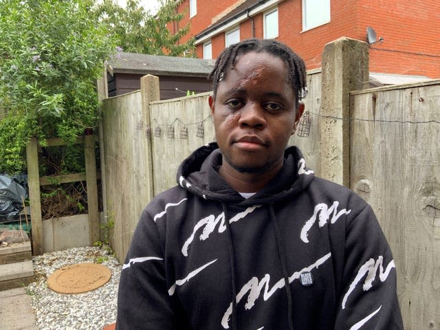 The NHS worker injured as he walked to a bus stop after finishing work at Southmead Hospital in Bristol in July 2020 (Claire Hayhurst/PA)