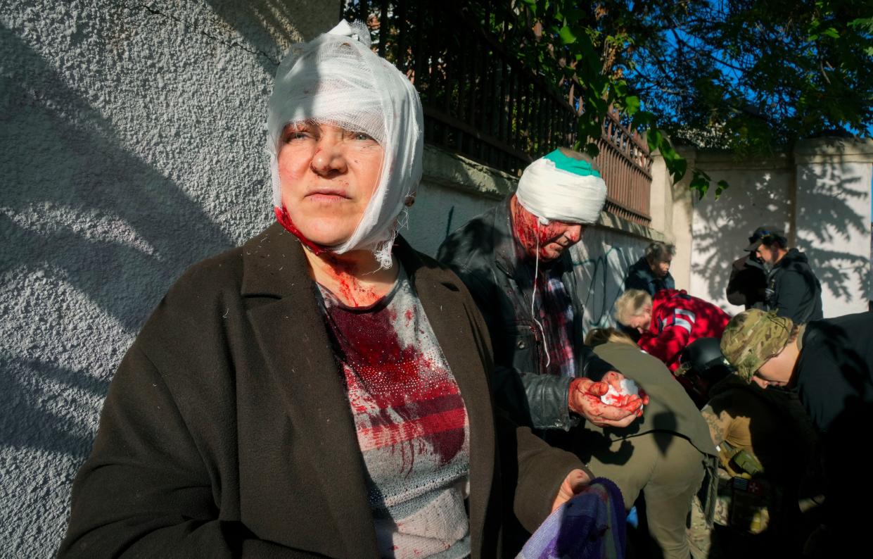 People receive medical treatment at the scene of Russian shelling, in Kyiv, Ukraine, Monday, Oct. 10, 2022. Two explosions rocked Kyiv early Monday following months of relative calm in the Ukrainian capital. 