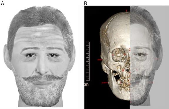 A facial reconstruction of Henry IV based on a mummified head held in a private collection.