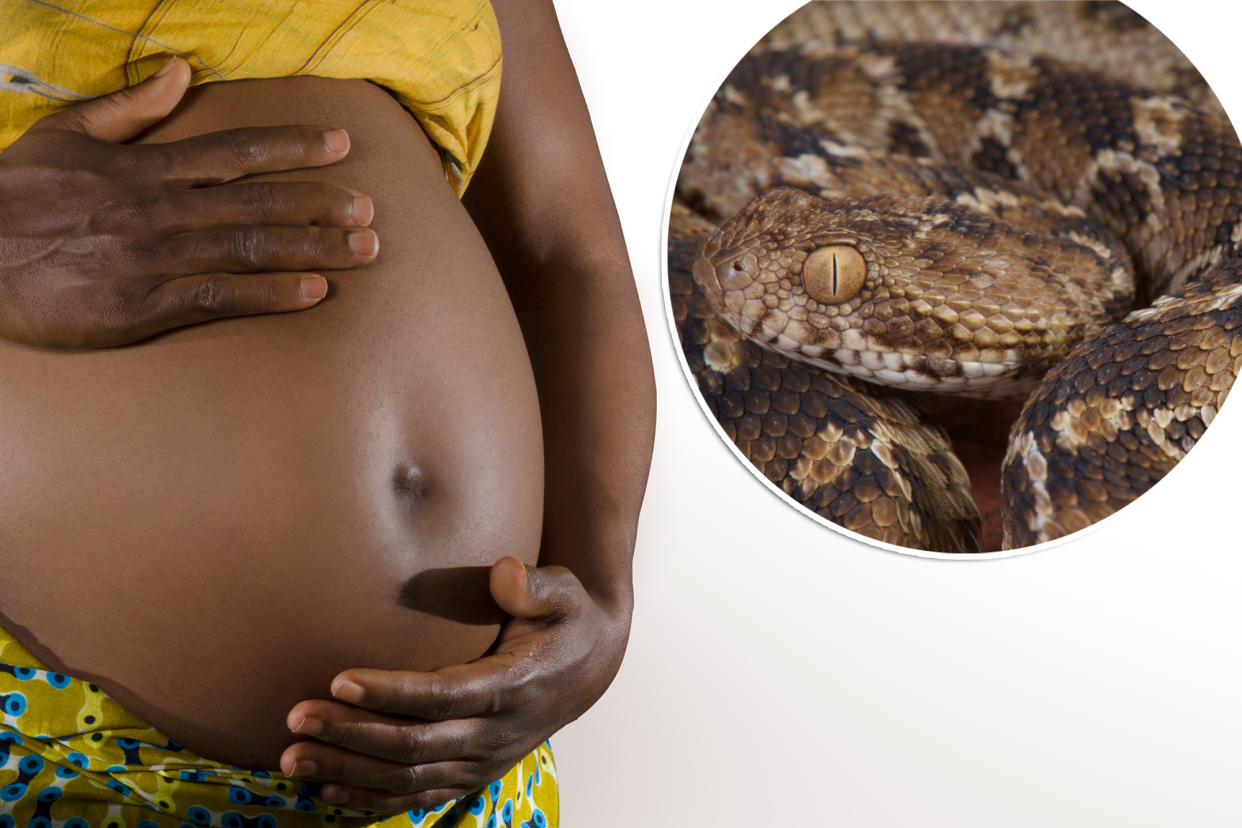 A Cameroon woman tragically died from a carpet viper bite mere hours after giving birth to her child, per a harrowing case study published in the New England Journal of Medicine.