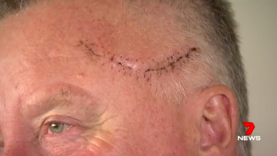 Rod Patterson was slashed by the Bourke Street attacked from his ear to his eye. Source: 7 News