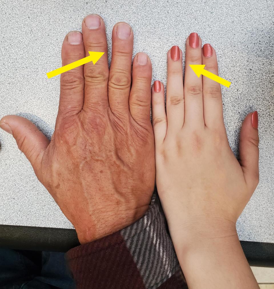 Hands with small gaps in them