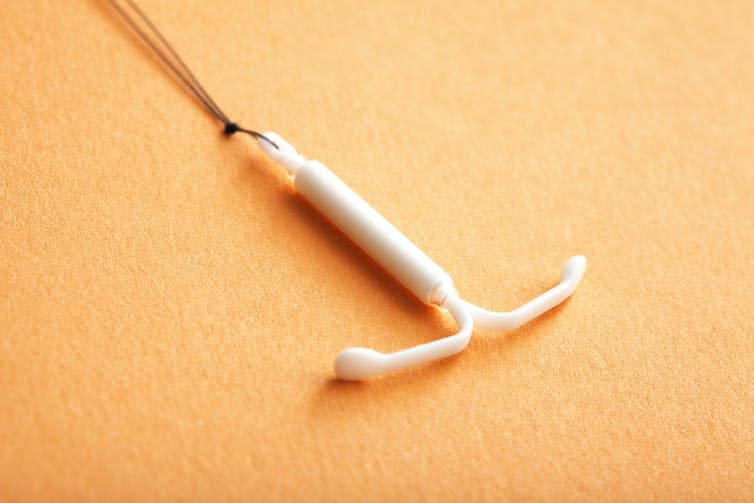 An intrauterine device.