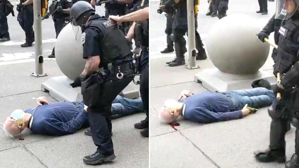 An elderly man lies on the ground bleeding from the head after being shoved by police in riot gear.