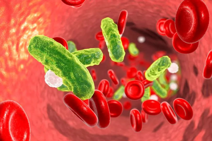 Septicemia in travellers can be lethal with a high death rate and potential for needing amputations