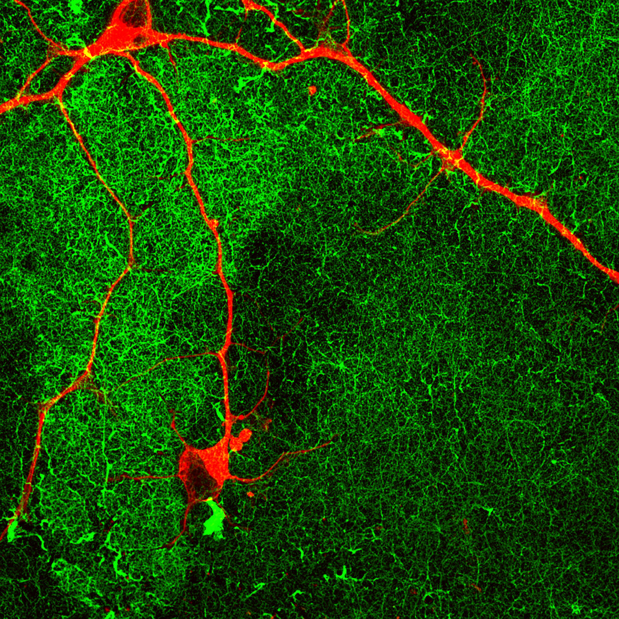 Human neurons