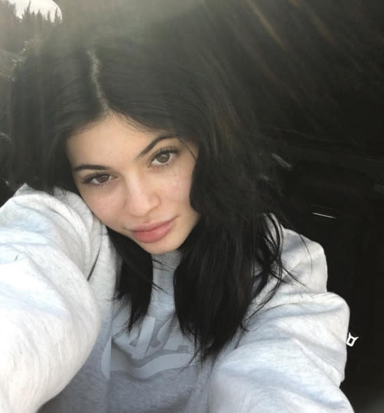 Kylie Jenner, looking as youthful as ever: “saw someone comment why I don’t embrace my freckles anymore. So here’s a freckle appreciation post” -@kyliejenner