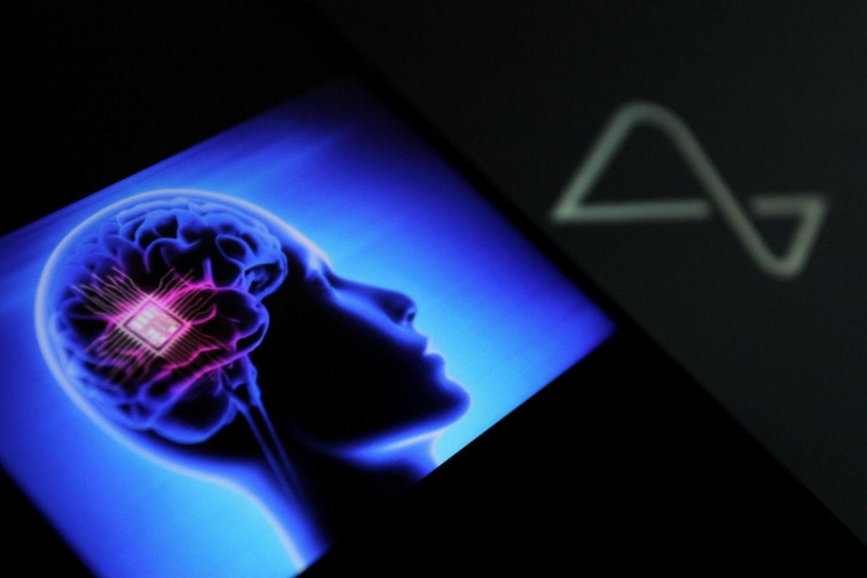 <span>The partial retraction of the threads connecting the chip to the patient’s brain has decreased the bits per second of the device.</span><span>Photograph: ZUMA Press, Inc./Alamy</span>