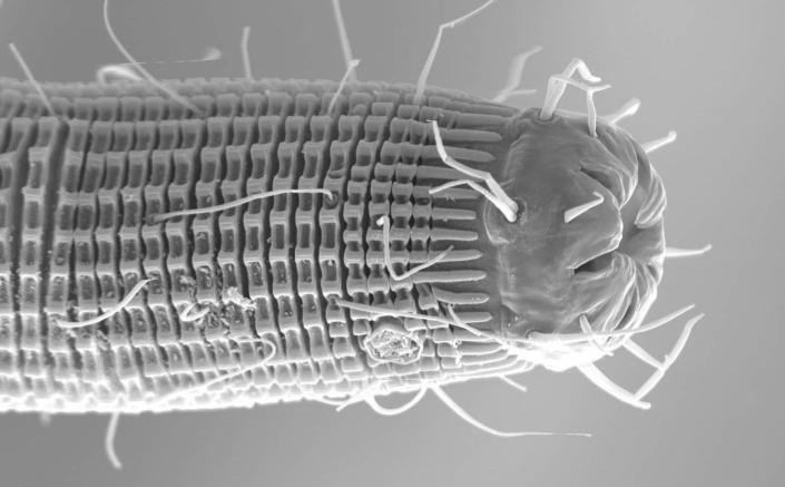 Imagen microscópica de nematodos Xyala.