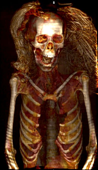 A scanned image of the Sreaming Woman mummy, showing her wig