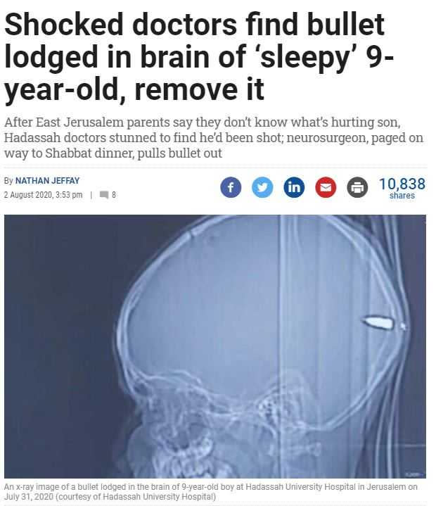 子彈卡在9歲男童腦中無人發現。（圖／unsplash）