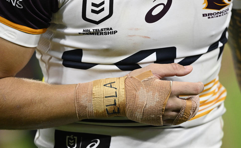 A close-up of Reece Walsh's fractured hand.