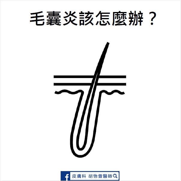 毛囊炎