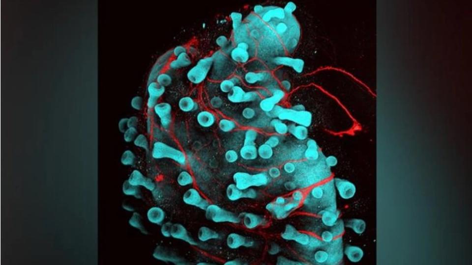 Esta superficie abultada es piel humana, con folículos pilosos, que se ha cultivado desde cero utilizando células madre "pluripotentes" que pueden convertirse en cualquier tipo de célula. Los investigadores esperan que este tipo de piel cultivada en laboratorio ayude a la investigación de enfermedades y mejore la cirugía reconstructiva, como los injertos de piel.