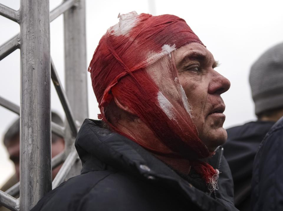 A wounded supporter of Ukraine's new government is seen after clashes with pro-Russian protesters in central Kharkiv