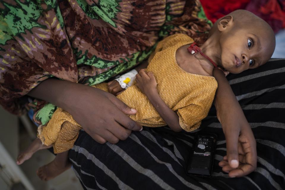 Hamdi Yusuf, a malnourished child, is held by her mother in Dollow, Somalia, September 21, 2022. / Credit: Jerome Delay/AP