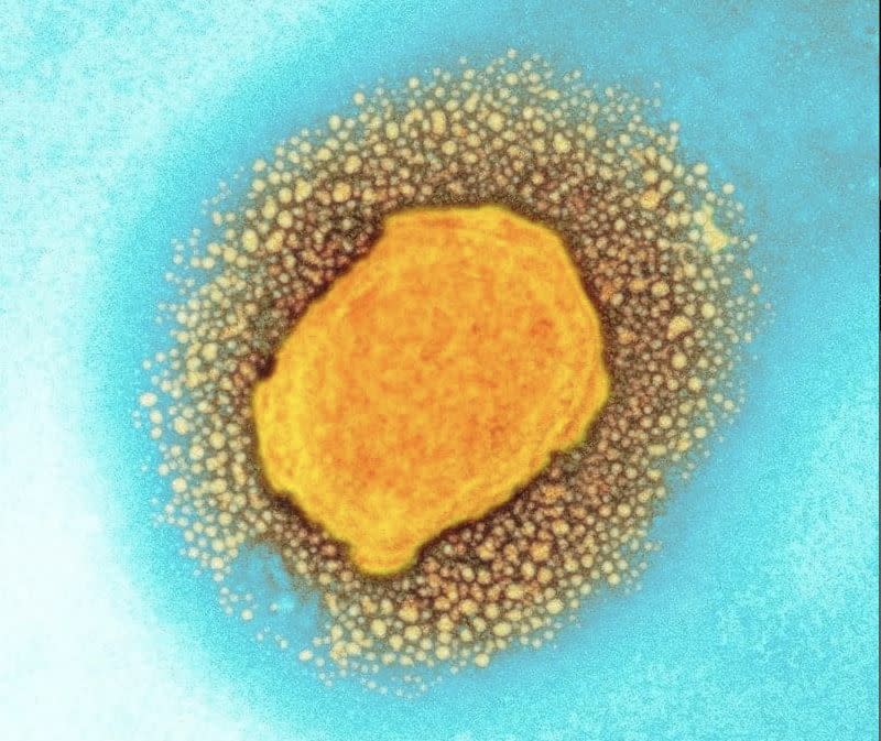 ▲圖為猴痘病毒彩色透射電子顯微照片。（圖／翻攝英國衛生安全局/科學圖片庫）