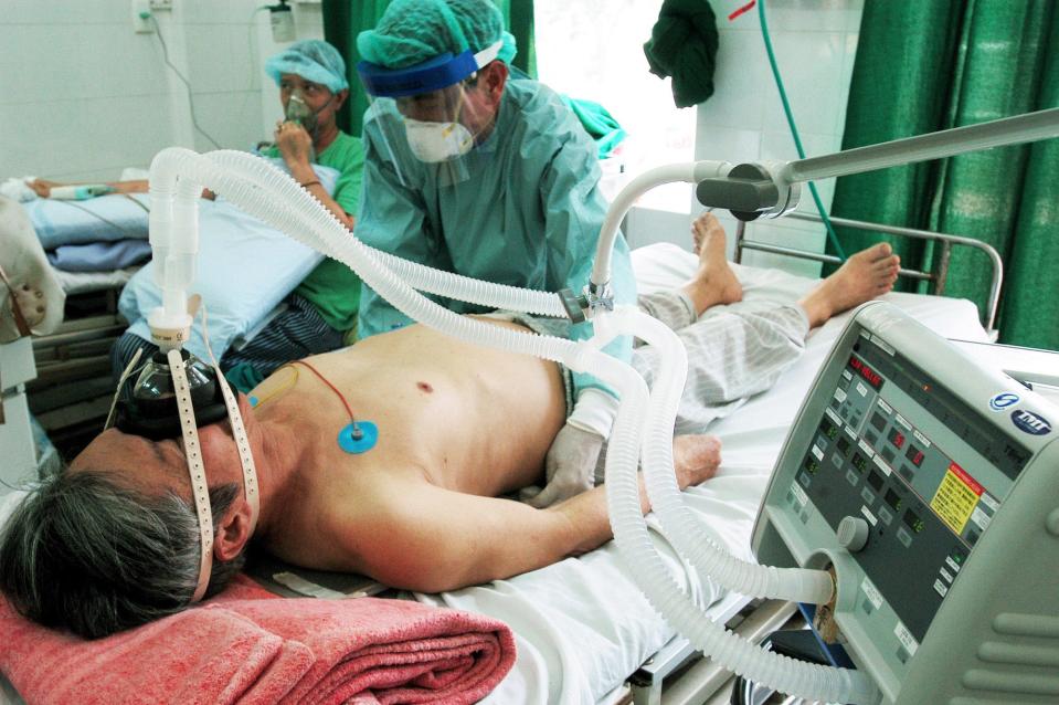 An Italian patient of Vietnamese origin, suffering from the pneumonia-like Severe Acute Respiratory Syndrome (SARS), breathes via a respirator in Hanoi's National Institute for Clinical Research in Tropical Medicine, April 3, 2003.