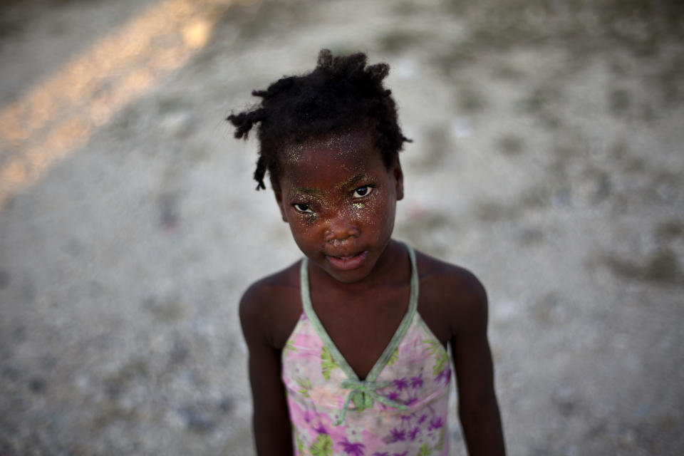 In this picture taken on Feb. 22, 2012, Komberline Herard, 7, poses for a photo after having her face made-up for a carnival celebration at La Piste camp in Port-au-Prince, Haiti. While more than a million people displaced by the 2010 quake ended up in post-apocalyptic-like tent cities, some of the homeless people with disabilities landed in the near-model community of La Piste, a settlement of plywood shelters along tidy gravel lanes. However, the rare respite for the estimated 500-plus people living at the camp is coming to an end as the government moves to reclaim the land. (AP Photo/Ramon Espinosa)