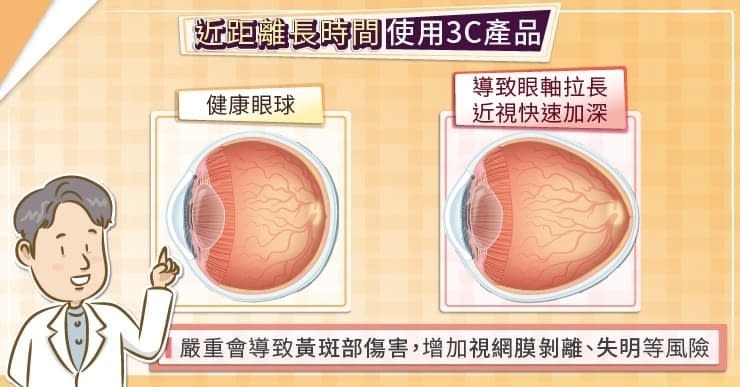 近距離、長時間使用3C產品