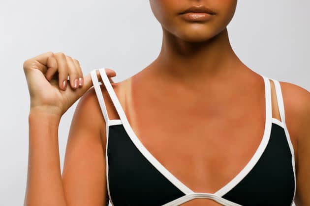 Avoid putting on a bra immediately after your spray tan.