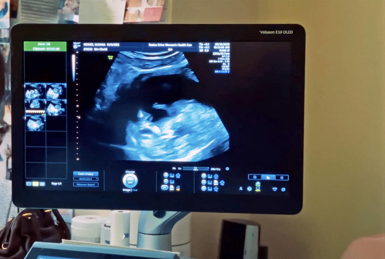 Ultrasound view. (Maluma via YouTube)